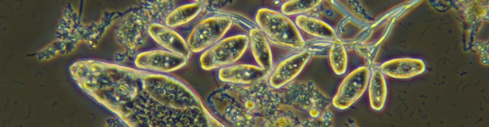 12 x100 stalked colony & rotifer.jpg