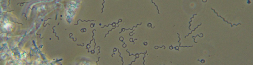 2 x400 spirochaetes.jpg